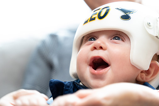Bebé tiene que usar un casco por plagiocefalia y su familia decide