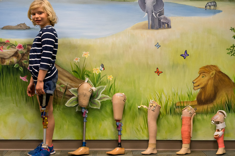 patient with series of prosthetic legs