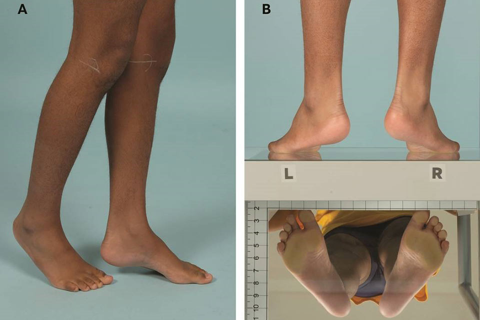 three images of feet