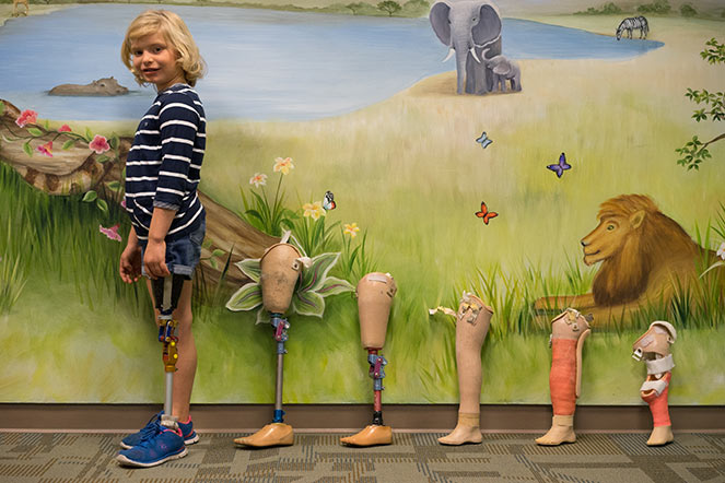 Gianna with her prosthetic legs