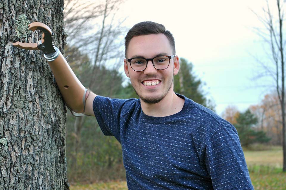 Lucas wearing prosthetic arm leaning on tree