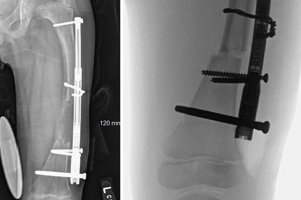 X-rays of Emmett's leg