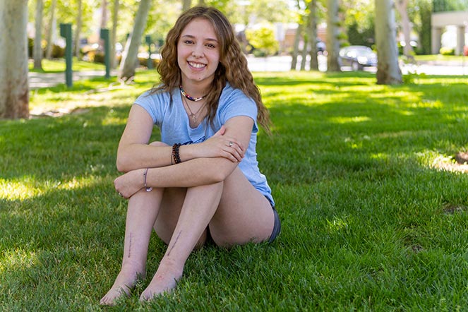 Abby sitting on grass