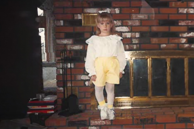 patient with limb difference standing in front of fireplace at home