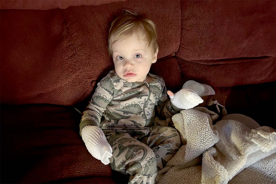 walker with bandaged hands on couch with blanket