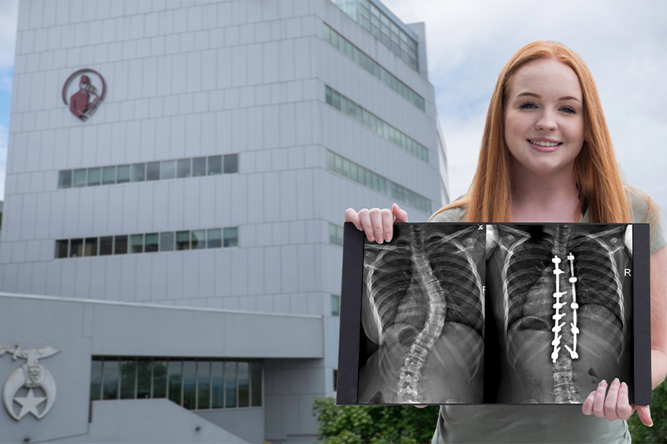 Scoliosis patient outside hospital
