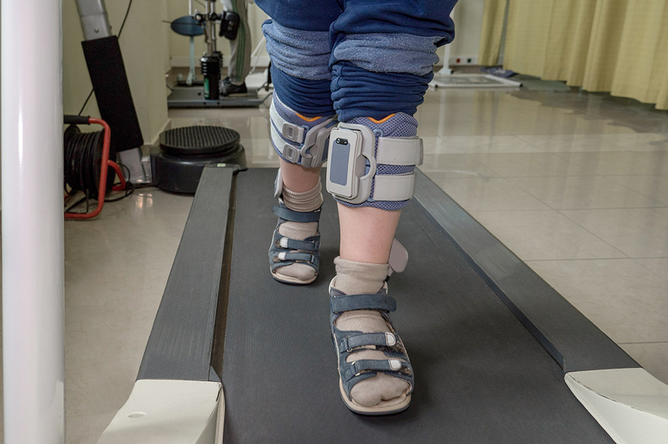 patient legs on electrical stimulation machine