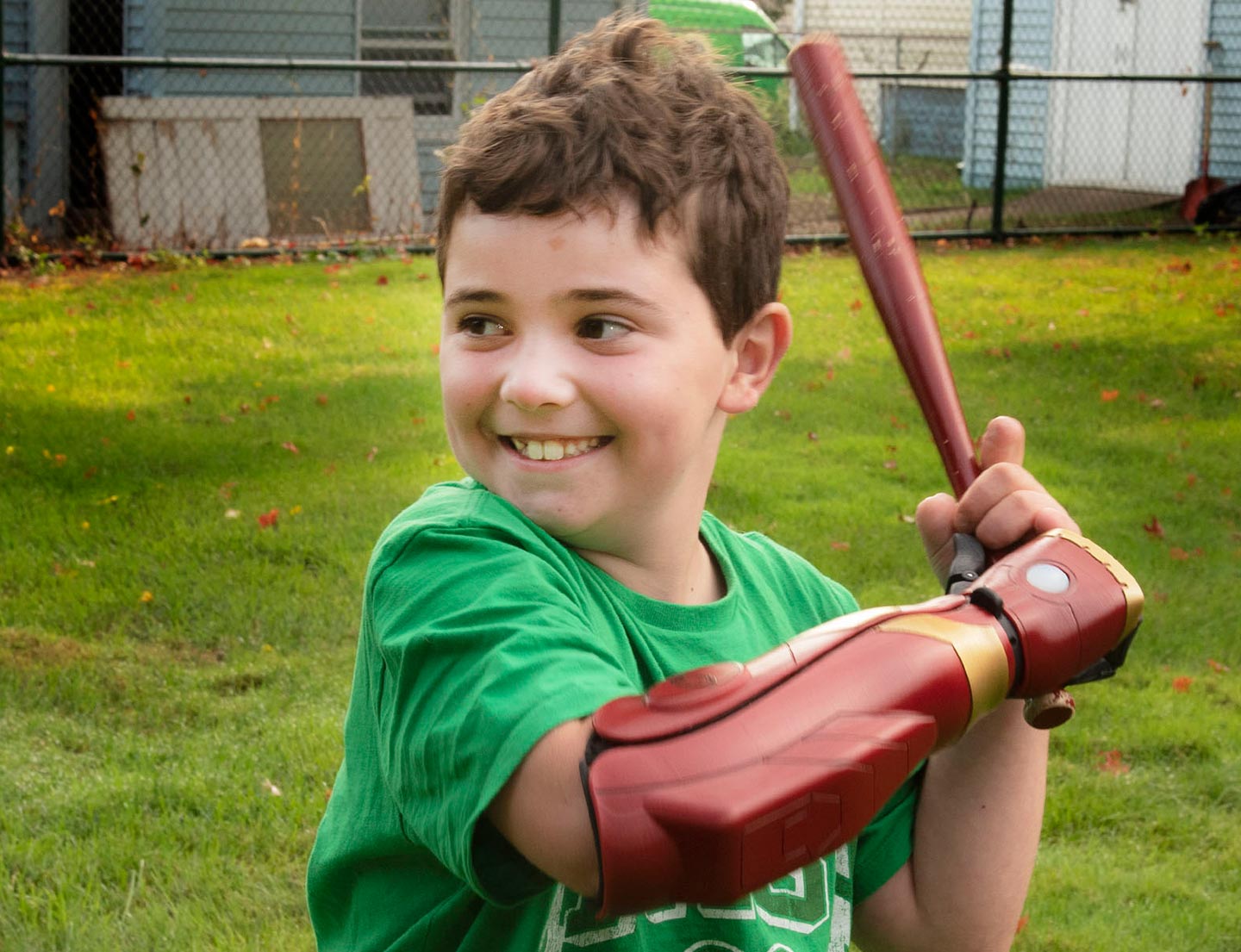 patient with prosthetic arm playing baseball
