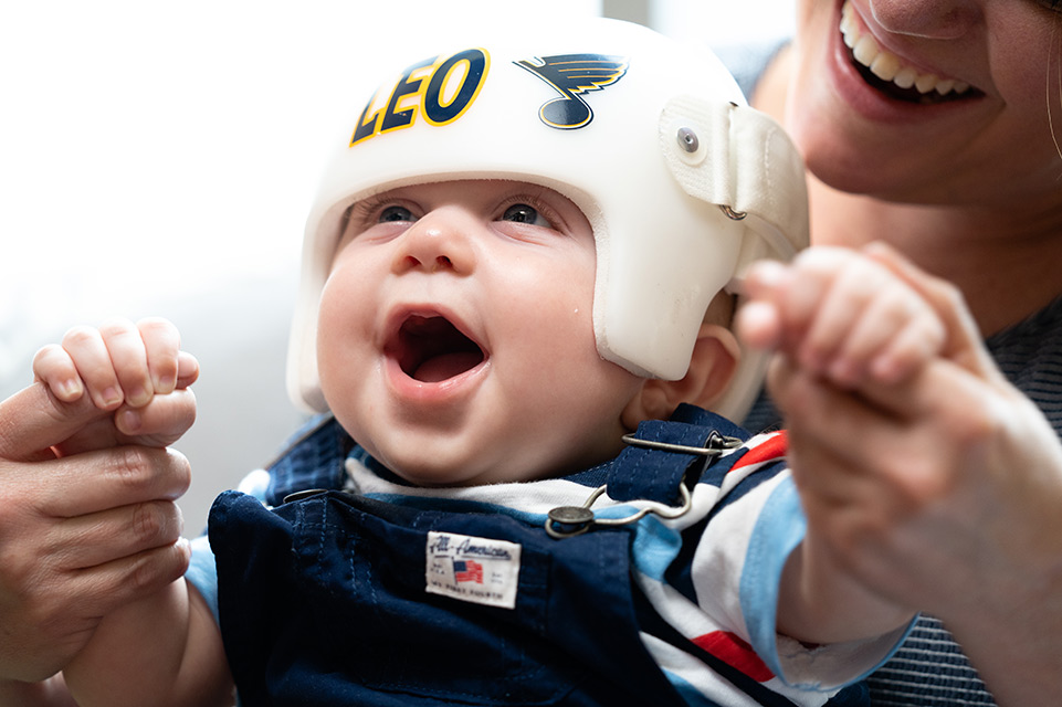 infant wearing helmet