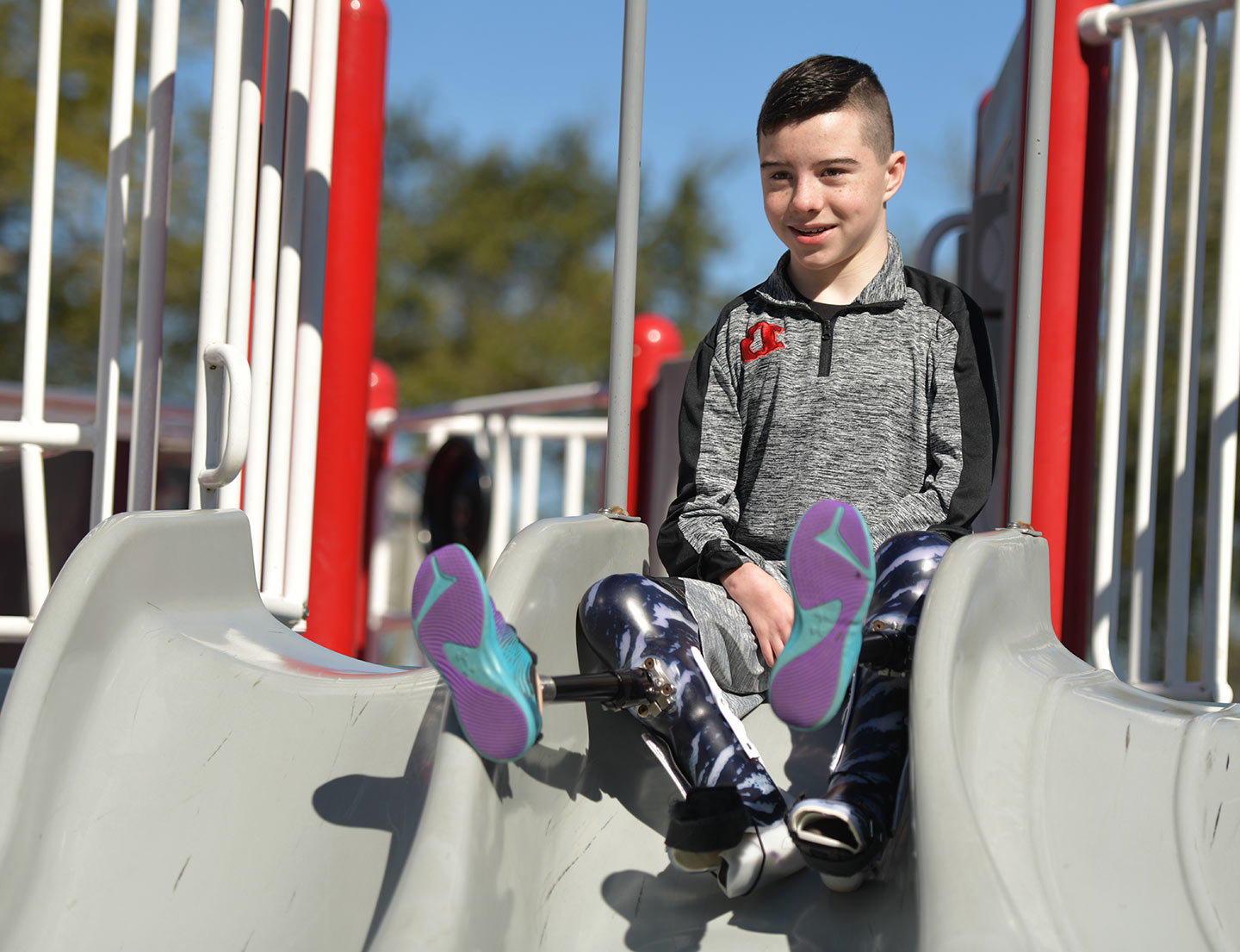 male patient with prosthetic leg on playground