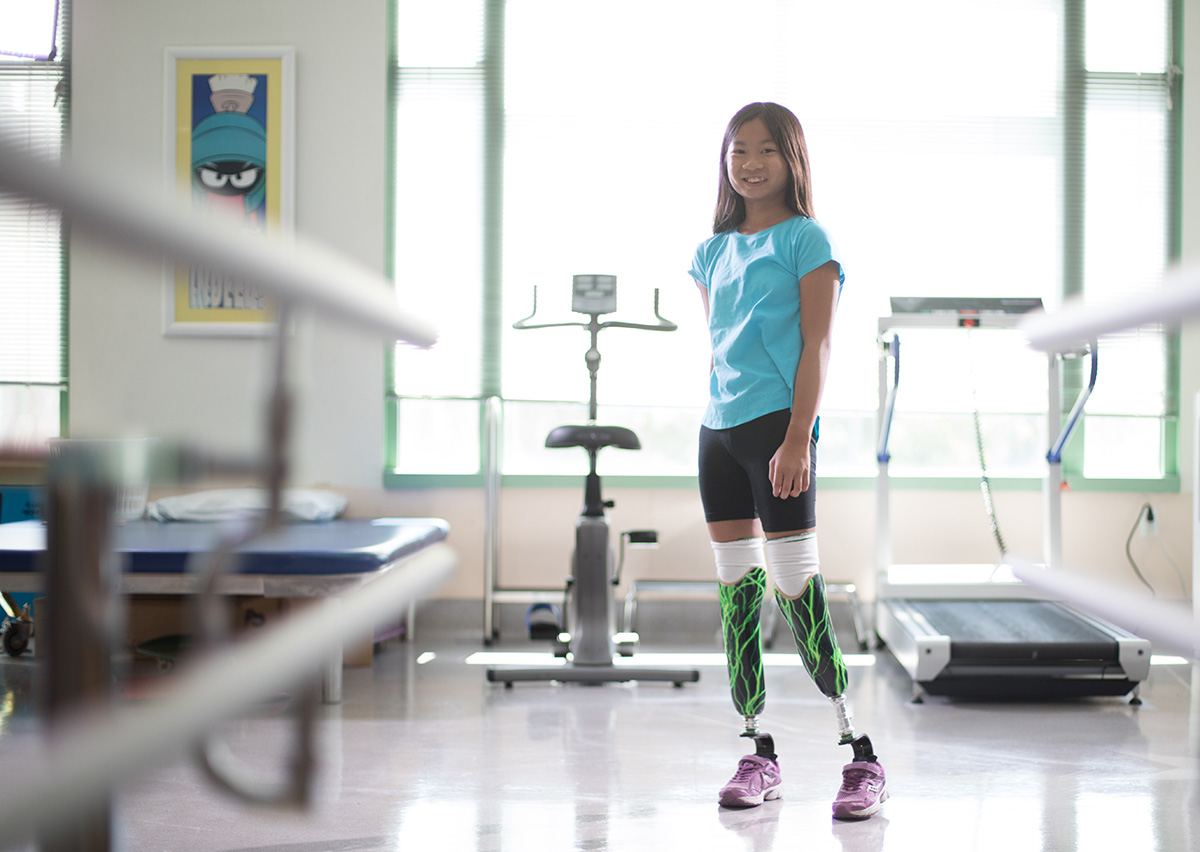 patient with two prosthetic legs in therapy gym