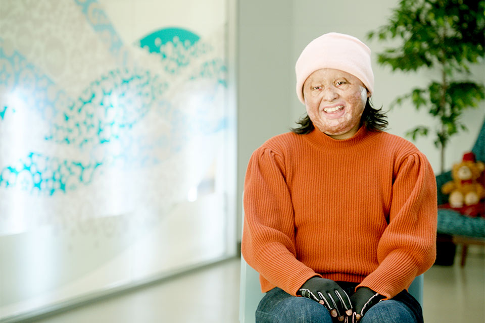 Une patiente brûlée assise et souriante