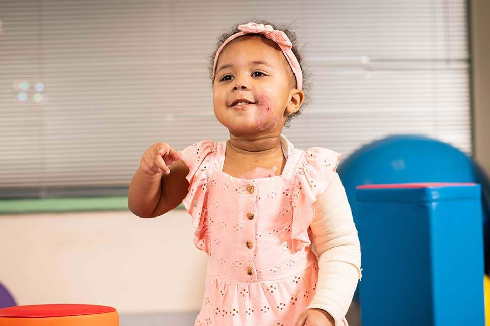 une patiente brûlée