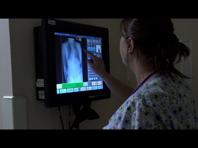 provider examining X-ray