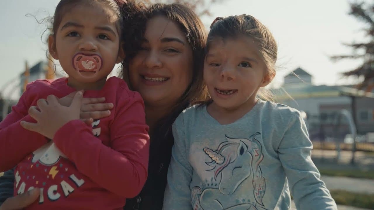 Cleft lip and palate and plastic surgery at Shriners Children's Ohio